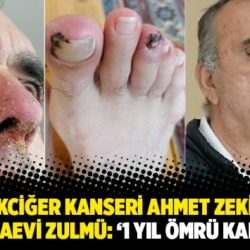 4. evre akciğer kanseri Ahmet Zeki Özkan ’a cezaevi zulmü: ‘1 yıl ömrü kaldı ’